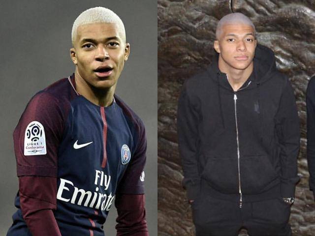 阿利松妻子晒术后照，阿利松此前因个人事务返回巴西